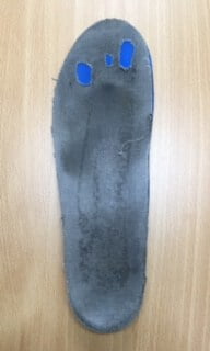 Caring For Your Orthotics-Used customised insole