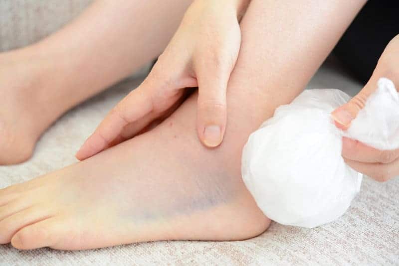 ice ankle pain